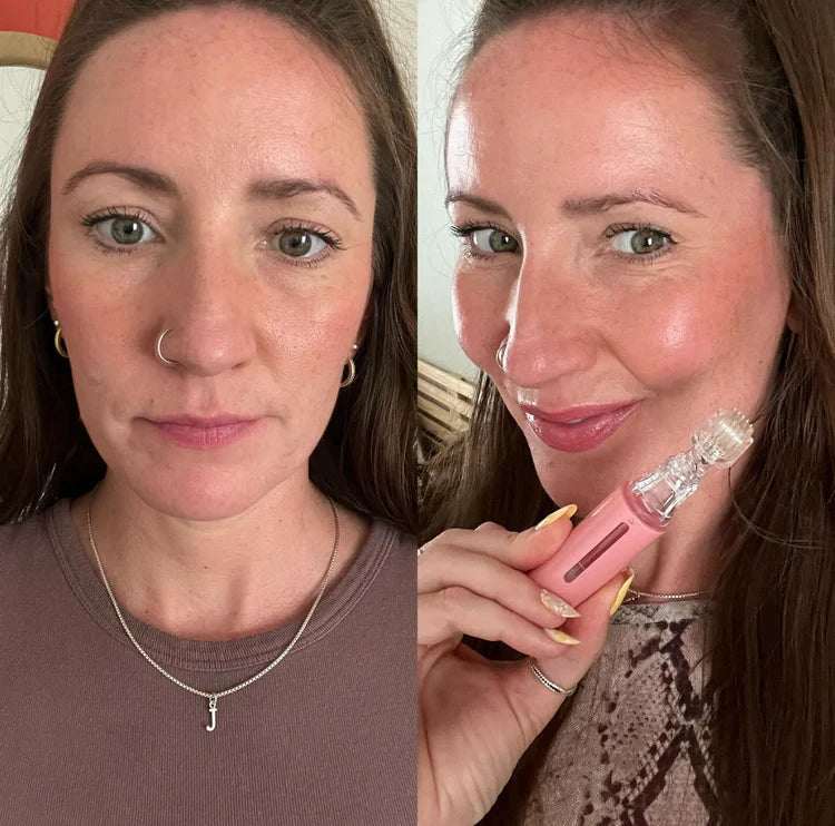 LipLift + Sérum Ácido Hialurónico